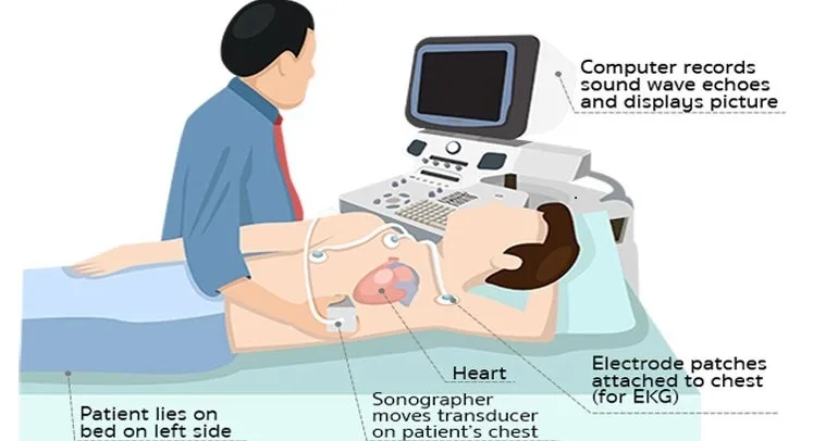 2D Echo (Echocardiography)