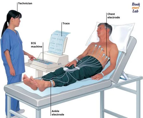 ECG (Electrocardiogram)