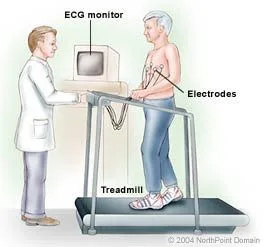 TMT (Treadmill Stress Test)