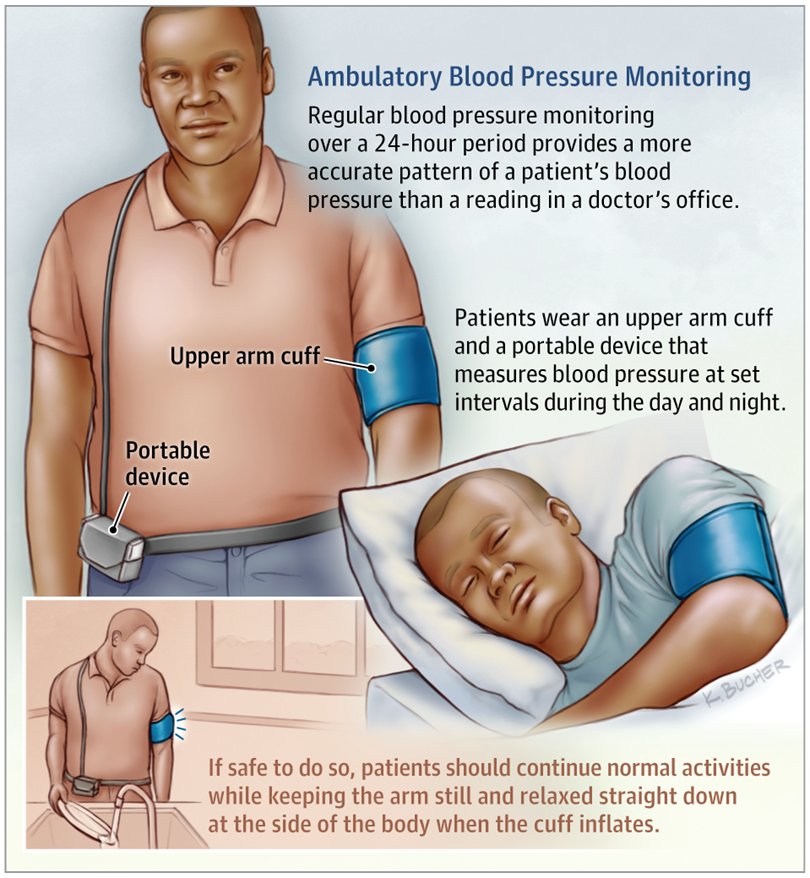 AMBULATORY BP MONITOR